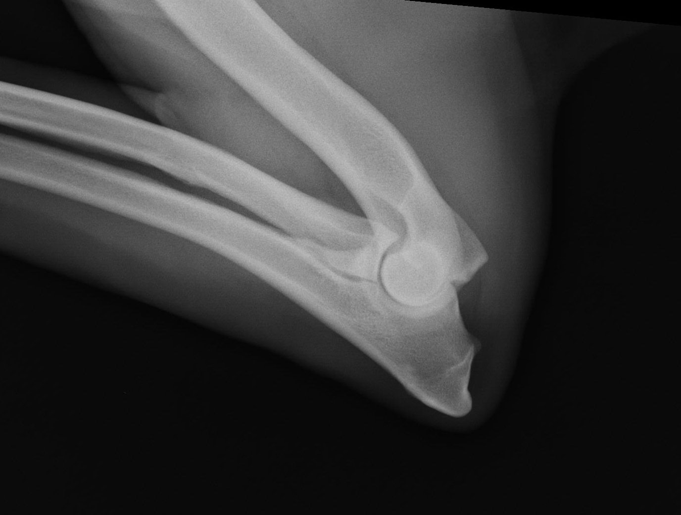 Elbow Dysp Card Elbow Dysp Card