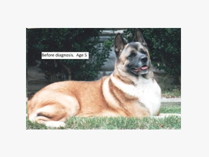 SA Before Diagnosis Age 5